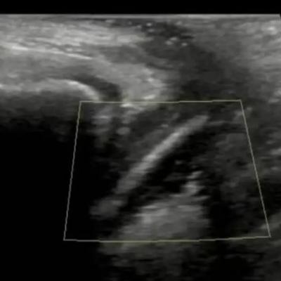 笔杆先生：真是让人后怕！最近广东发生了一