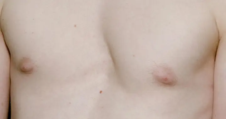 两乳之间的“出气筒”——膻中穴，专治各种不开心