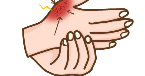 4·20世界痛风日 | 止痛更要治本，教您中西医科学“对抗”痛风