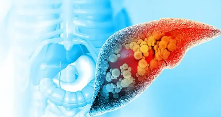 肝最喜欢的一种水果，春天开始这样吃，补肝血、疏肝郁，人舒坦