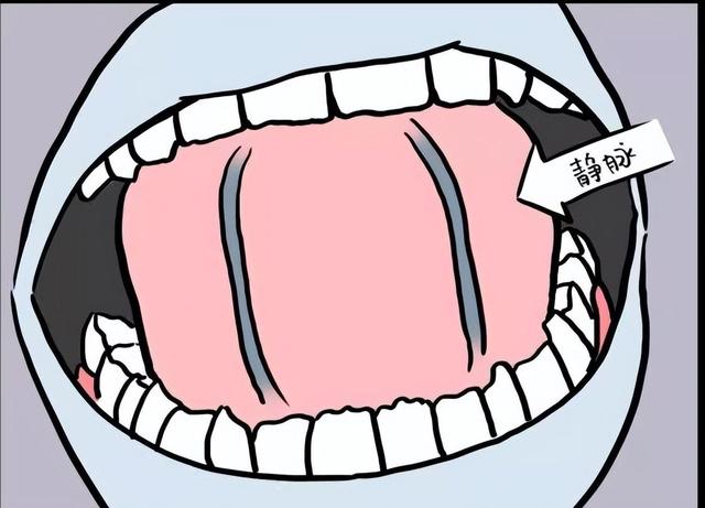 舌下青筋又粗又黑，血瘀怎么办，教你打通脉络