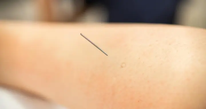 针刺外关穴治疗感冒的临床经验总结