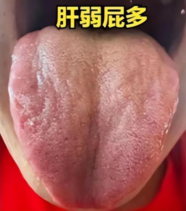 肝不好屁多、脾不好痰多、肾不好尿多，一个中成药帮你调五脏