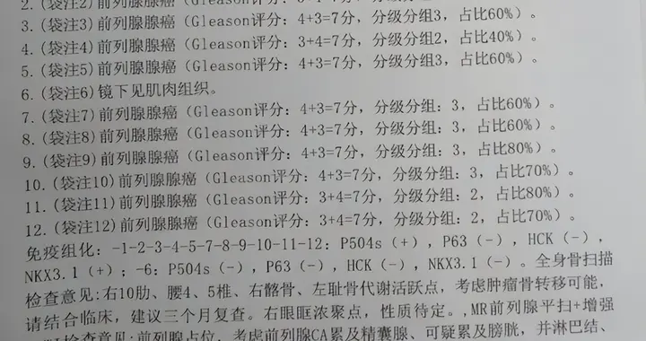62岁前列腺癌淋巴结、骨转移——病理报告解读