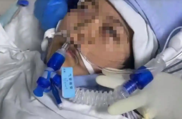 3月10日，再次震惊麻醉界！这个监护措施普及应用刻不容缓！