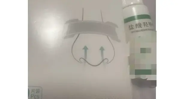 喷了就通，停了更堵？冬季鼻塞慎用这类“唑啉”药物