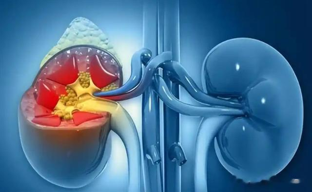 医生提醒：最伤害肾脏的行为，不是憋尿！而是频繁的去做这5件事