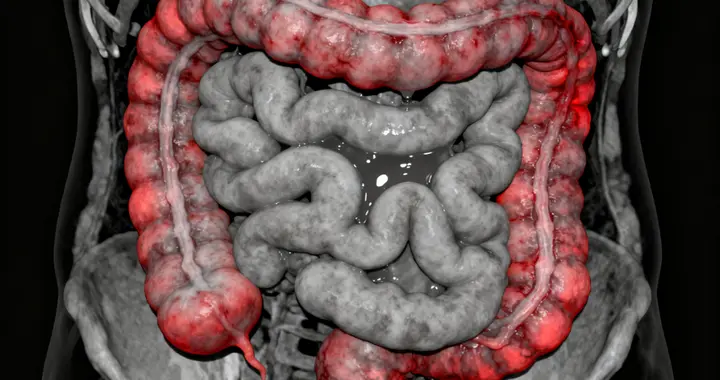 比四神丸更灵的小胶囊，温补脾肾散寒湿，吃凉就拉、五更泻全好了