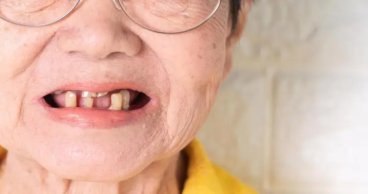 别小看掉牙，真的能偷走你的晚年寿命