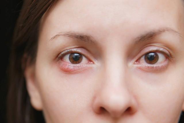 眼睛出现这5种异常别大意！可能是疾病的前兆，趁早去医院查查！