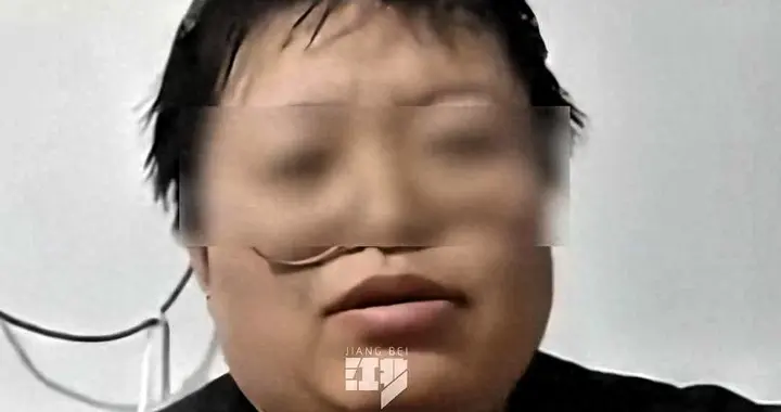 患者家属发声，带1000去北京嫣然看病，一分钱没花还包吃住。