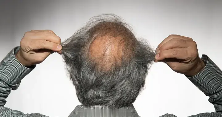 男性能活多久，看头发就知？提醒：若有这4症状，尽早引起重视！