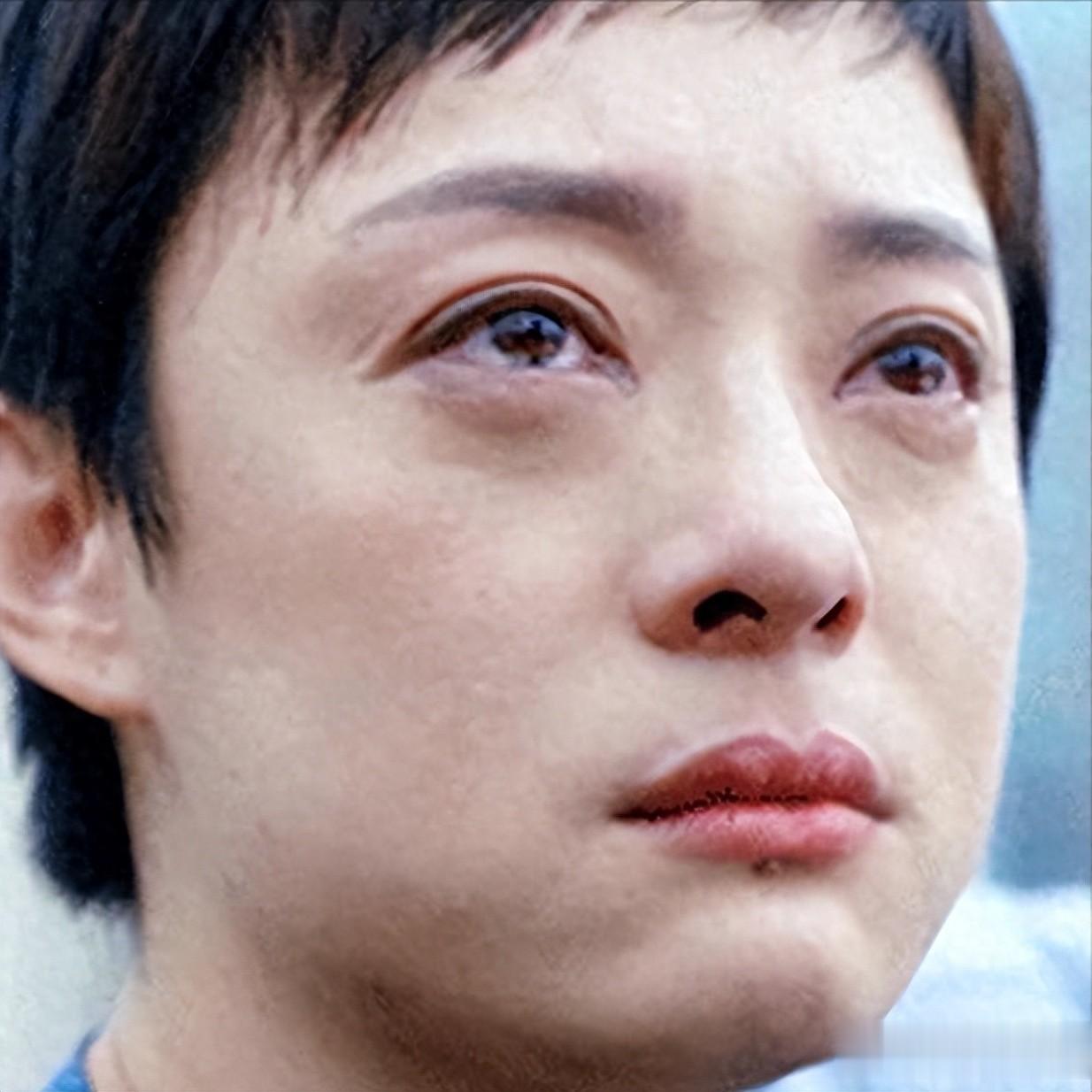 热搜压不住了，孙俪眼睛被“气”眼睛血管破裂，担心的事还是发生