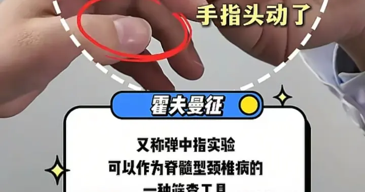 弹一弹中指，轻松自测颈椎病