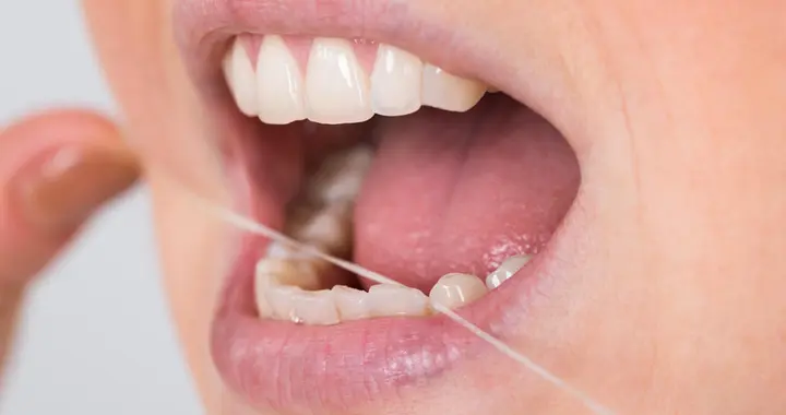 牙齿敏感如何改善？