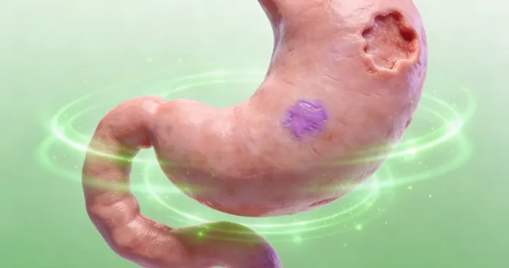 老胃病反复闹，吃啥都疼，只知道达喜？这个优秀国产药，建议收藏