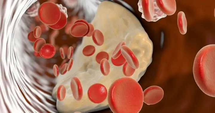 你的血管正在悄悄“长斑”？这件事现在知道还不晚！