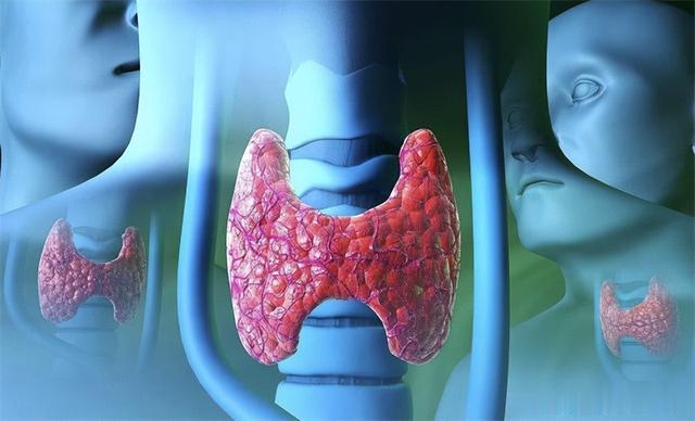 “碘盐大户”被公布，是咸菜的20倍，医生：不想甲癌缠身，早扔掉