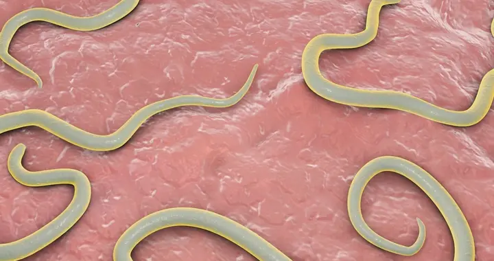 浑身都是寄生虫的3种鱼，卖鱼商贩都不敢吃，白送也千万别要