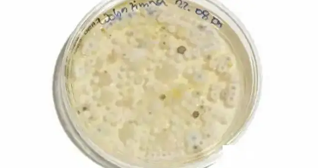 比砒霜还毒！煮120度都没用，这东西一口就能要命，无药可救！