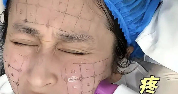 为美对自己下狠手，颖儿喊疼的热玛吉，伊能静每年保养花销七位数