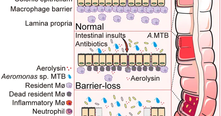 肠道菌群暗藏“刺客”？南大团队发现溃疡性结肠炎新致病机制 | 光锥读论文