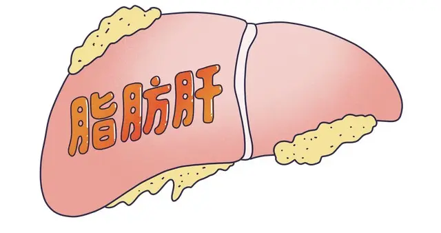 这4个无意识的行为，让你的脂肪肝会越来越严重！现在知道还不晚