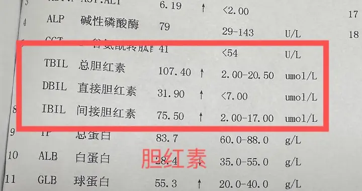 不用吃药！胆红素从35降到19，只需平时做好这4点！