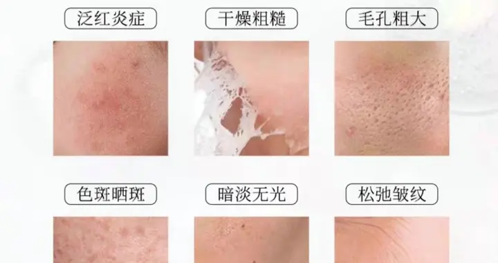 你还在为肌肤问题烦恼吗？小小一瓶珍珠精华液，帮解决不少问题