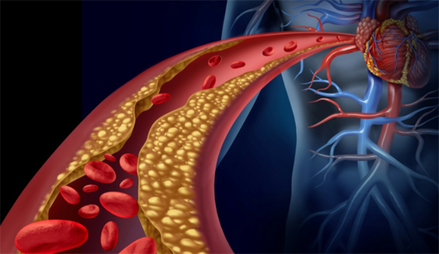 阿托伐他汀早上吃还是晚上吃？科学解答服药时间之谜
