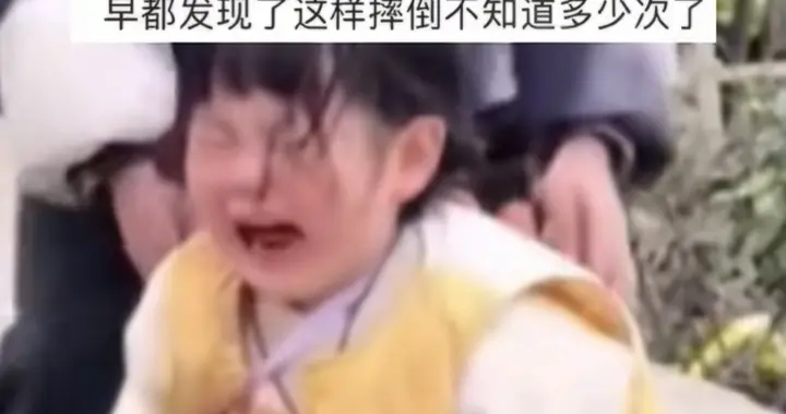 四岁女孩一摔，摔出了千万生意与童年争议