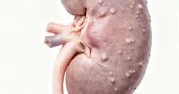 肾虚的人能剧烈运动吗？医生：这3种方式易伤肾，应及时避免