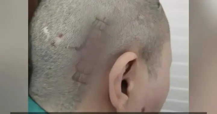 装“脑起搏器”戒毒，却放出了另一只野兽：技术狂欢下的灵魂失守