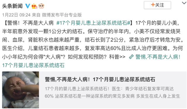 17个月宝宝查出结石？竟然是家长一个喂养习惯导致的！