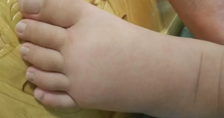 脚上一旦出现有3种异常，十有八九是肝肾出问题了，尽早检查！