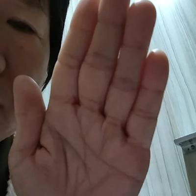 叹世：万能的网友，看看我这手指有啥毛病没