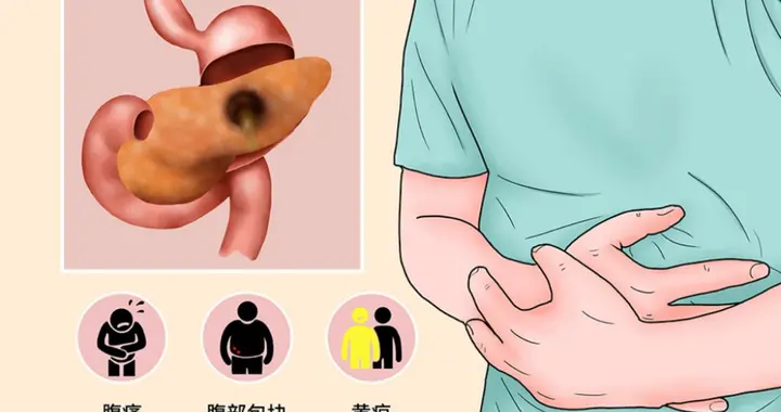 学医后知道：胰腺炎最危险信号，不是腹胀，而是持续出现4种异常