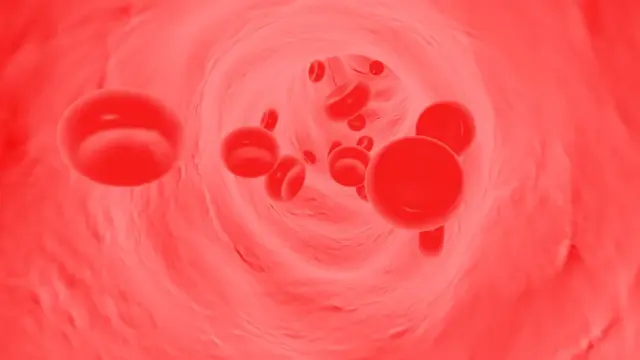 血管堵塞的人，脸上腿上可能会有这8种表现，要提高警惕