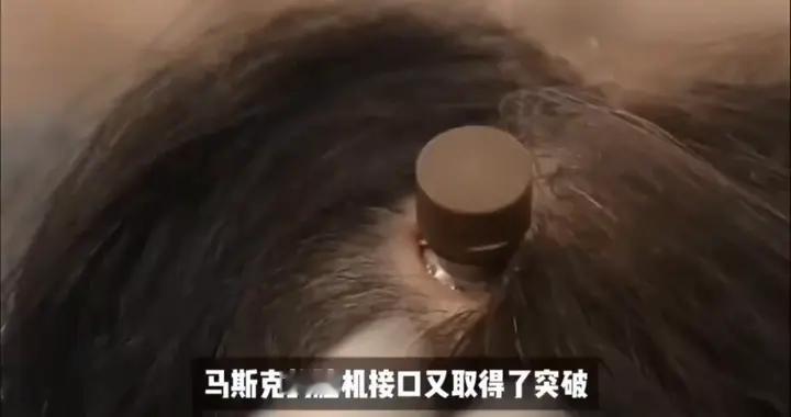 脑机接口︱让失明者重见光明！马斯克正把科幻变成现实