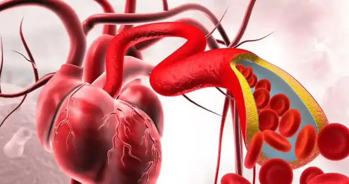 日本冠心病的死亡率为世界最低，他们3个好习惯，值得我们学习