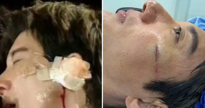 别再成为下一个黄家驹！王力宏被缝39针后，荒唐的一幕发生