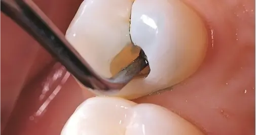 牙齿发黄发黑别忽视，80% 口臭藏着肠胃 / 肾脏隐患，及时排查