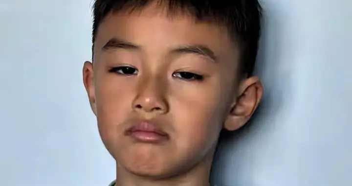 男孩发烧十几个小时 退烧后脸变黑