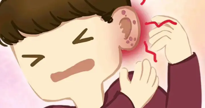 外耳道炎药物灌注治疗，缓解症状，快速有效！