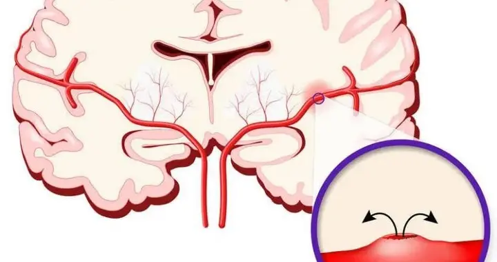 冬季气温下降，血压升高怎么办？记好这些中医养生建议！