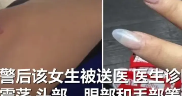 23岁中国留学生悉尼被打惨：遭2名陌生女子暴打，详情曝光太气愤