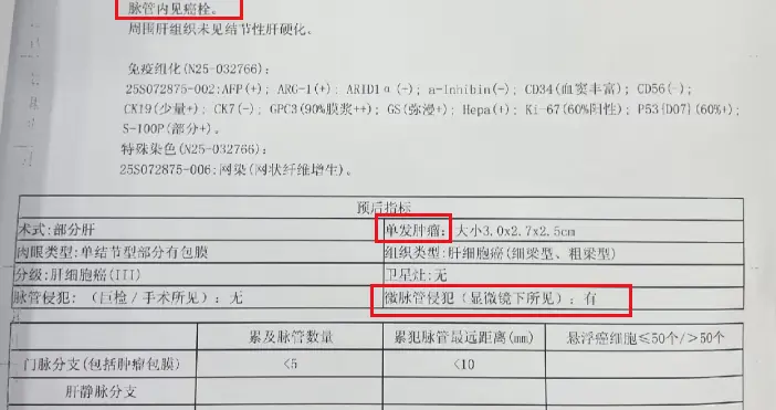53岁肝细胞癌，III级，见脉管侵犯——病理报告解读