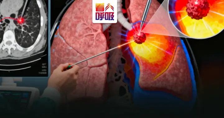 大伯痛失肺癌手术时机，微创技术扭转结局！