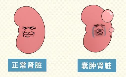 分享3味中药，治疗肾囊肿时发挥大作用！