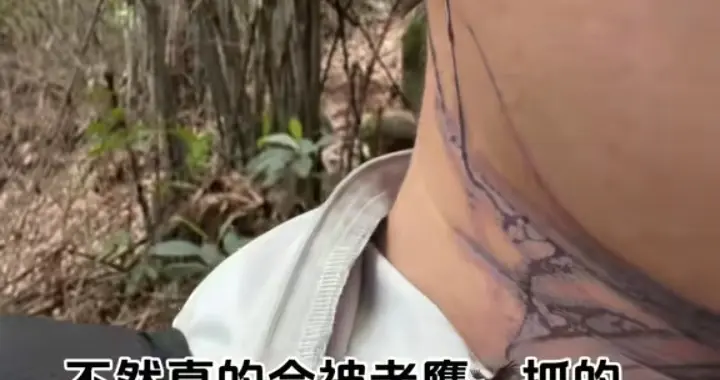 罕见！老鹰主动攻击人类，一捡菌的男人被不知名东西多次攻击！